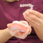 How Invisalign Facilitates Better Oral Hygiene Compared to Traditional Fixed Braces